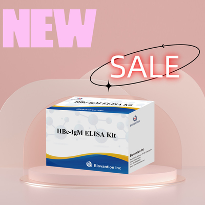 Yüksek hassasiyetli HBc IgM Antjen Reagent Diagnostik Testi Enzim Bağlı Immunosorbant Test Kits ile