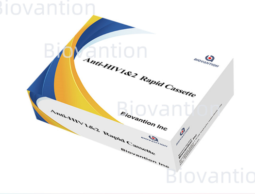 Hızlı test reagansı HIV 1/2 25 test ile kolloidal altın testi yöntemi