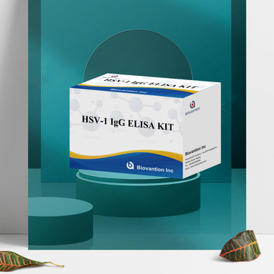 Yüksek Duyarlılıklı HSV-1 IgG Serolojik tespit için Immunoassay Test Kits Plasma Örneği Tipi