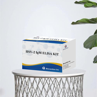 Hızlı ve Kesin Sonuçlar için Yüksek Spesifikiteli Elisa Test Kits HSV-2 IgM İnsan Kullanımı Tıbbi Reagansı