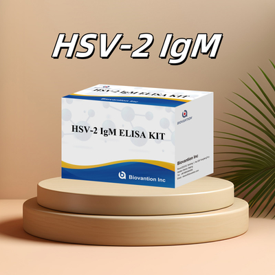 Hızlı ve Kesin Sonuçlar için Yüksek Spesifikiteli Elisa Test Kits HSV-2 IgM İnsan Kullanımı Tıbbi Reagansı