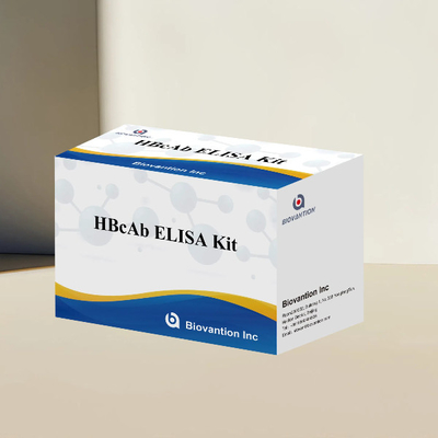 HBcAb ELISA Test Kütesi Assay Antibody Deteksiyon Kütesi Nitelik