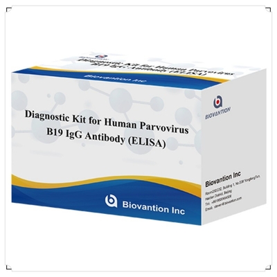Fabrika Doğrudan Satış İnsan Parvovirus B19 IgM Antibody Elisa Test Kit 96T ile B19 ELISA Kit