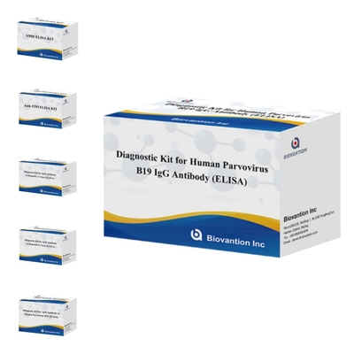 Fabrika Doğrudan Satış İnsan Parvovirus B19 IgM Antibody Elisa Test Kit 96T ile B19 ELISA Kit
