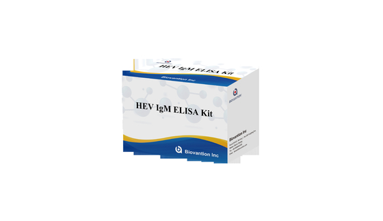 Laboratuvar veya Hastane Hepatit E Virüsüne Karşı IgG HEV Elisa Test Kits