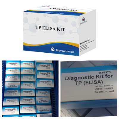 Sıcak satış ELISA testi Sifilis Antibody Enzim Bağlı Immunoassay Elisa Test Kit