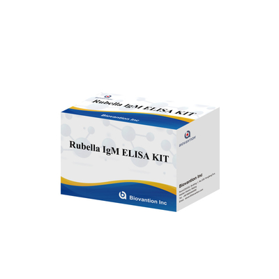 İnsanlarda kullanılan Rubella IgG antikorları için Elisa Rubella IgM tespit aracı
