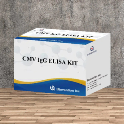 Laboratuvar veya Hastane Yüksek Doğruluklı CMV IgG Elisa Test Kits