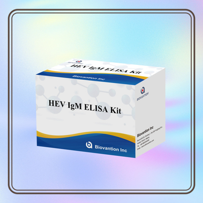 Doğru ve Duyarlı Elisa Test Kits HEV-IgM Teşhis ve Analiz İçin