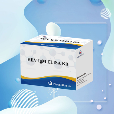 Kesin ve Duyarlı HEV-IgM Elisa Test Kitsini Kesin Bulma ve Analiz İçin