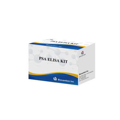 Elisa Test Kiti Toplam ve Serbest PSA Prostat Spesifik Antigen için % 99'dan fazla doğruluk 8 X 12 şeritli ambalaj