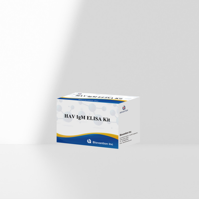 HAV IgM ELISA Kit Yüksek Duyarlılık Hepatit A Virüs tespiti Klinik laboratuvarlar için güvenilir doğru teşhis testi