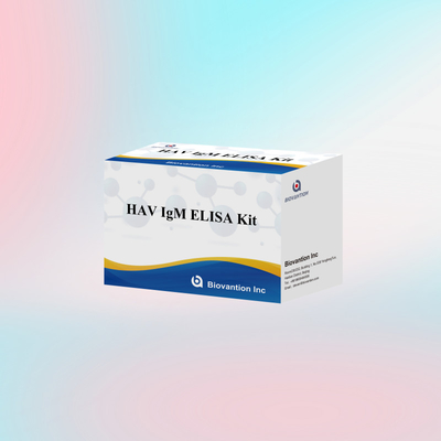 HAV IgM ELISA Kit Yüksek Duyarlılık Hepatit A Virüs tespiti Klinik laboratuvarlar için güvenilir doğru teşhis testi