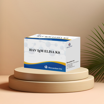 HAV IgM ELISA Kit Yüksek Duyarlılık Hepatit A Virüs tespiti Klinik laboratuvarlar için güvenilir doğru teşhis testi