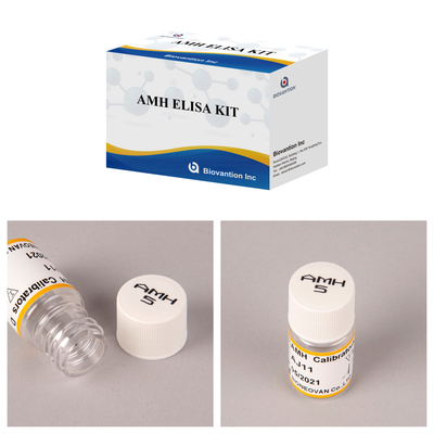 Yüksek Duyarlılıklı Anti-Mullerian Hormonu / AMH Elisa Kit, Hastalıkları Kesin ve Hızlı Keşfetmek İçin