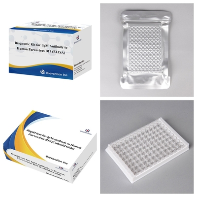Gelişmiş İnsan Parvovirus B19 IgM Antibody ELISA Test Keti Hamilelik tespiti ve taraması için