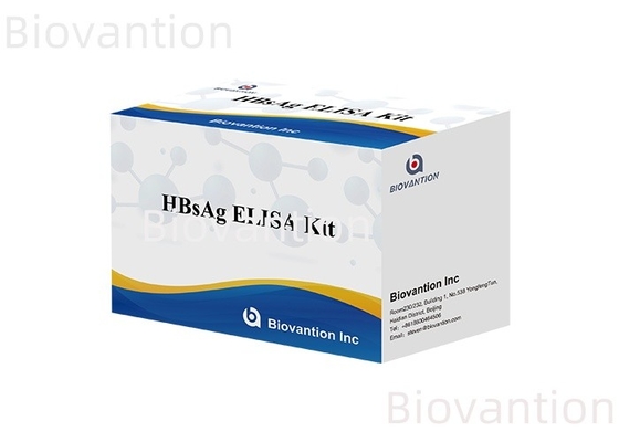 Farklı maddelerin doğru tespiti için Yüksek Duyarlılıklı HBsAg Elisa Test Kiti