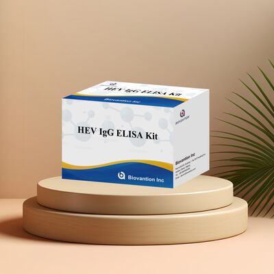 Hepatit E Tanısı için 96'lık Boyut ve 18 Ay Raf Ömrüne Sahip Yüksek Hassasiyetli HEV-IgG ELISA Test Kiti