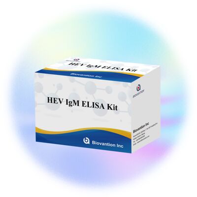 Yüksek Duyarlılıklı HEV IgM Elisa Test Kits 96T Boyutlu ve 2-3 Saatlik Doğruluğu Sağlayan Test Zamanı