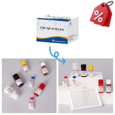 96T CMV ELISA Test Kiti, Renkölçer Algılama ve Sandviç Yöntemi ile Sitomegalovirüs Antikorları İçin