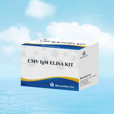 96T CMV ELISA Test Kiti, Renkölçer Algılama ve Sandviç Yöntemi ile Sitomegalovirüs Antikorları İçin