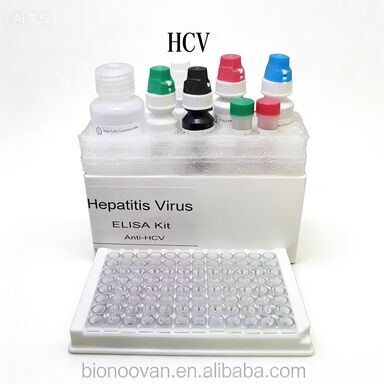 Hepatit C Virüsüne Karşı Anti-HCV Antikorları Enzim Bağlı Taşıma Zamanı Kısa