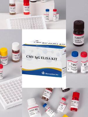 Laboratuvar veya Hastane Yüksek Doğruluklı CMV IgG Elisa Test Kits