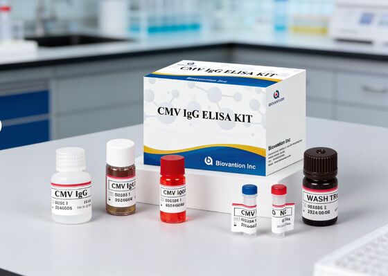 Laboratuvar veya Hastane Yüksek Doğruluklı CMV IgG Elisa Test Kits