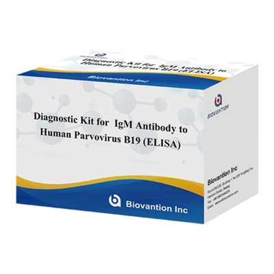 İnsan Parvovirus B19 IgM Antibody ELISA Diagnostic Kit Eritema Infectiosum ve Hamilelikteki Komplikasyonlar için İdeal