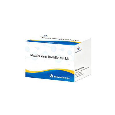 Kızamık Virüsü IgM ELISA Test Kütesi 96T Erken Akut Enfeksiyon tespiti